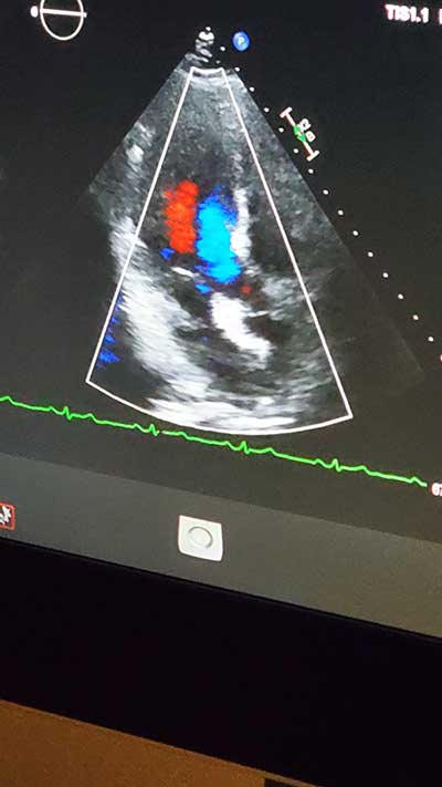 a screen scan showing the heart